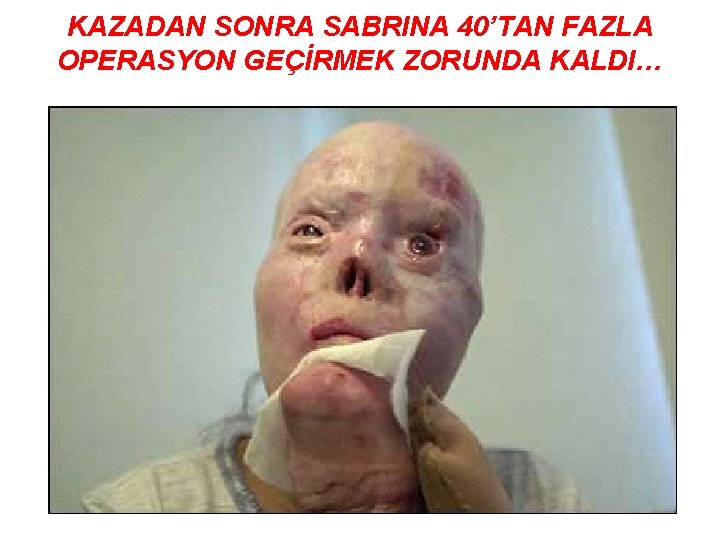 KAZADAN SONRA SABRINA 40’TAN FAZLA OPERASYON GEÇİRMEK ZORUNDA KALDI… 