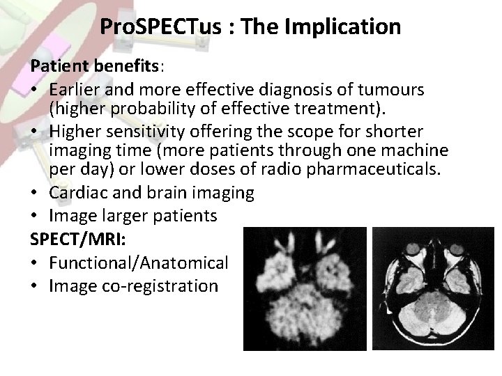 Pro. SPECTus : The Implication Patient benefits: • Earlier and more effective diagnosis of
