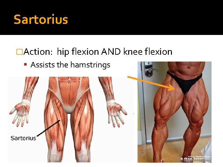 Sartorius �Action: hip flexion AND knee flexion Assists the hamstrings 