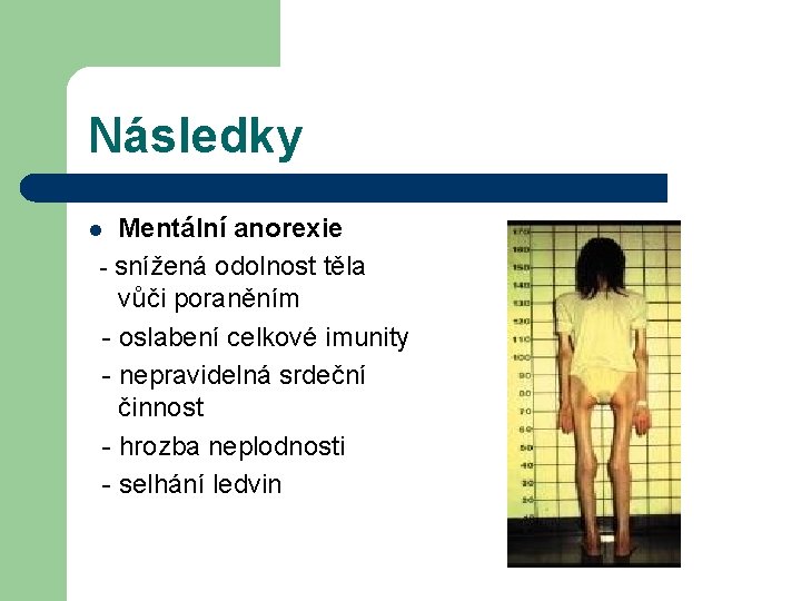 Následky Mentální anorexie - snížená odolnost těla vůči poraněním - oslabení celkové imunity -