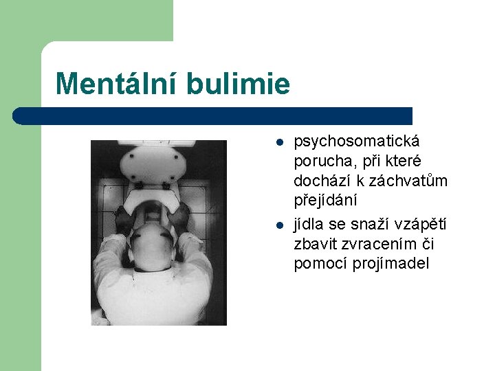 Mentální bulimie l l psychosomatická porucha, při které dochází k záchvatům přejídání jídla se