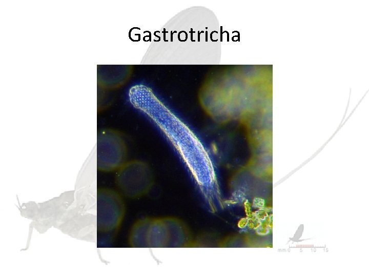 Gastrotricha 