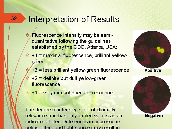 39 Interpretation of Results Fluorescence intensity may be semiquantitative following the guidelines established by