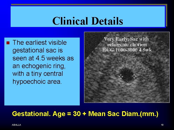 Clinical Details n The earliest visible gestational sac is seen at 4. 5 weeks