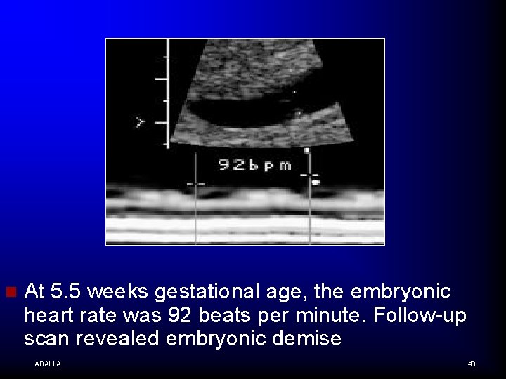 n At 5. 5 weeks gestational age, the embryonic heart rate was 92 beats