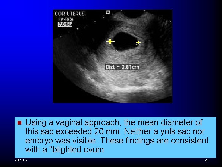 n Using a vaginal approach, the mean diameter of this sac exceeded 20 mm.