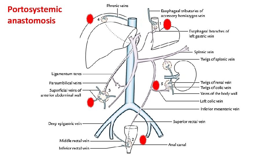 Portosystemic anastomosis 