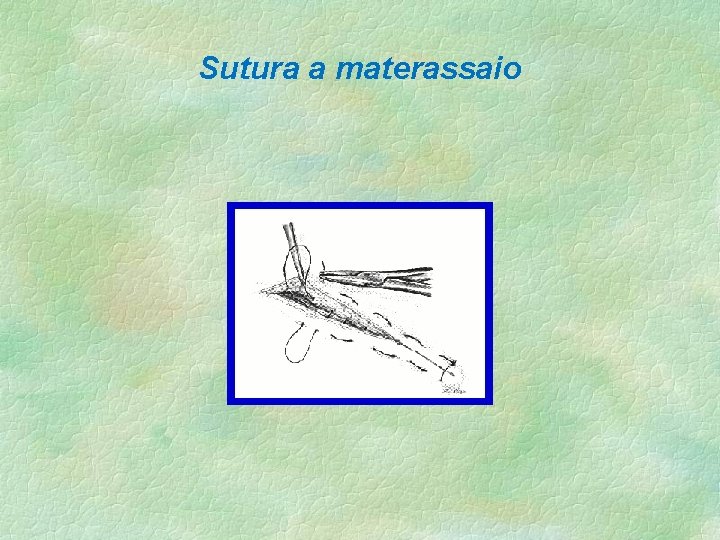 Sutura a materassaio 