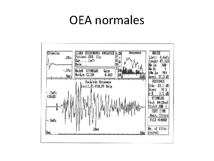 OEA normales 