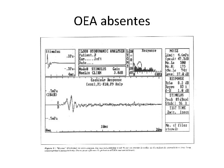 OEA absentes 