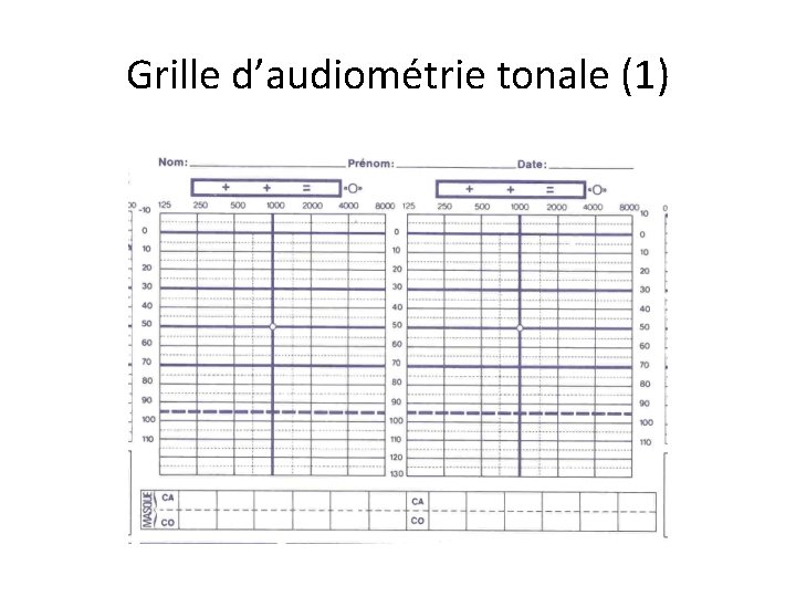 Grille d’audiométrie tonale (1) 