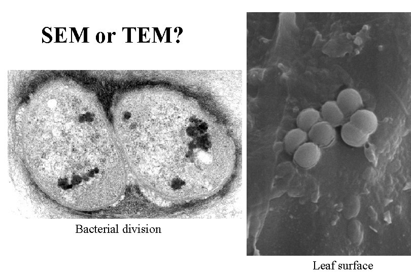 SEM or TEM? Bacterial division Leaf surface 
