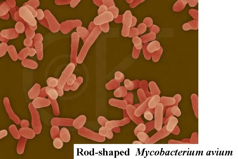 Rod-shaped Mycobacterium avium 