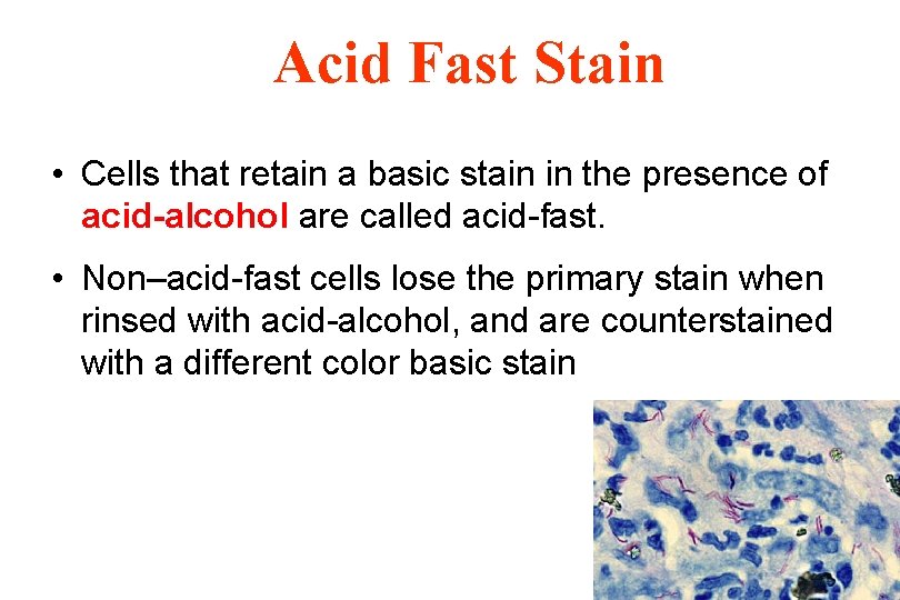 Acid Fast Stain • Cells that retain a basic stain in the presence of