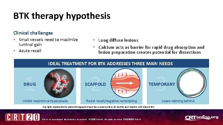 BTK therapy hypothesis Clinical challenges • Small vessels need to maximize luminal gain •