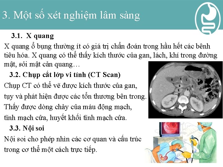 3. Một số xét nghiệm lâm sàng 3. 1. X quang ổ bụng thường