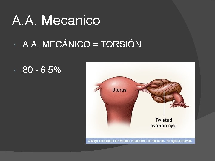 A. A. Mecanico A. A. MECÁNICO = TORSIÓN 80 - 6. 5% 