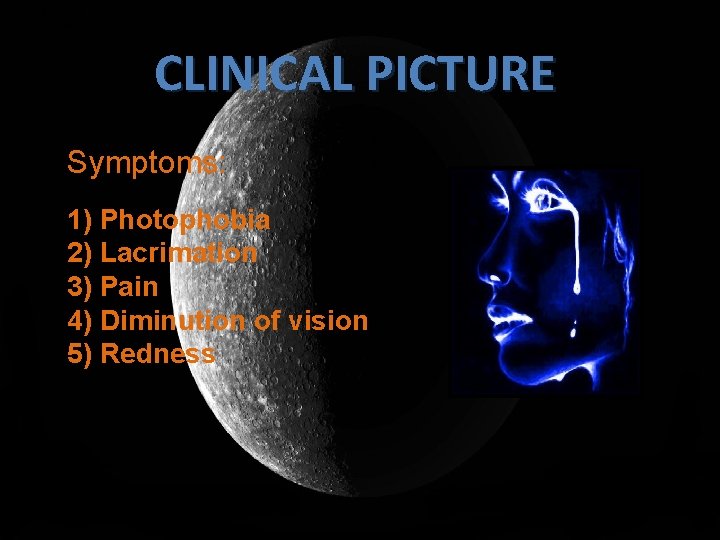 1)Photophobia 2)Lacrimation CLINICAL PICTURE Symptoms: 1) Photophobia 2) Lacrimation 3) Pain 4) Diminution of