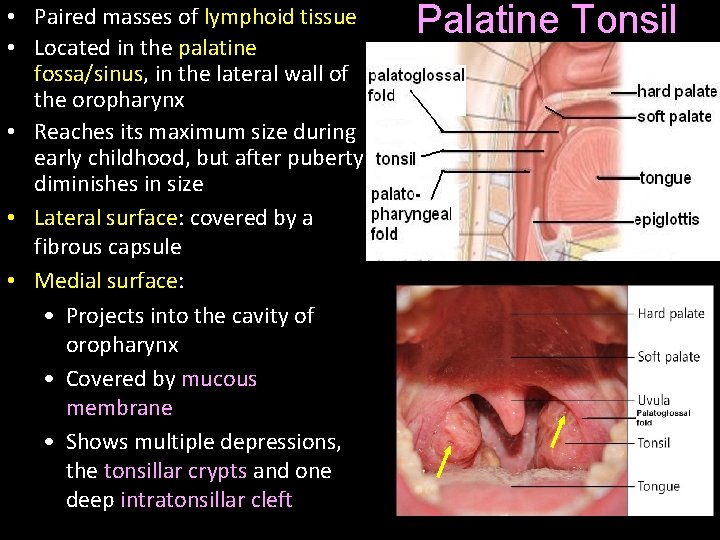  • Paired masses of lymphoid tissue • Located in the palatine fossa/sinus, in