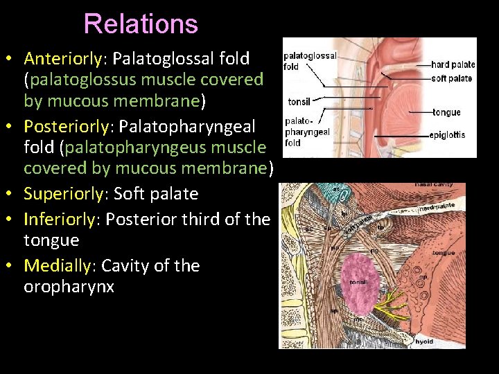 Relations • Anteriorly: Palatoglossal fold (palatoglossus muscle covered by mucous membrane) • Posteriorly: Palatopharyngeal