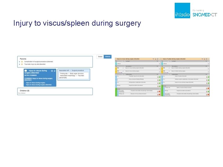 Injury to viscus/spleen during surgery 