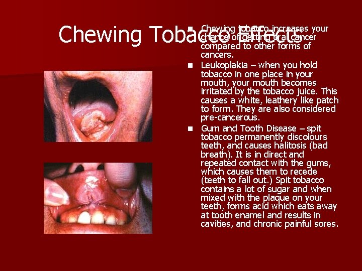 Chewing Tobacco Effects Chewing tobacco increases your chance of getting oral cancer compared to