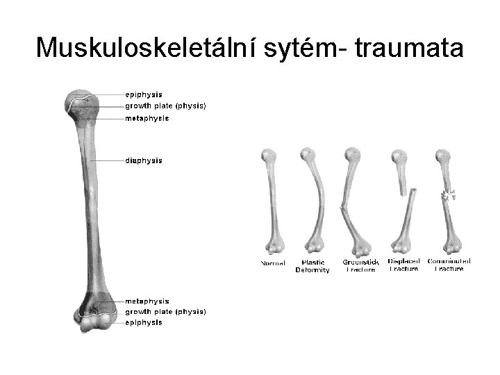 Muskuloskeletální sytém- traumata 