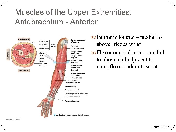 Muscles of the Upper Extremities: Antebrachium - Anterior Palmaris longus – medial to above;