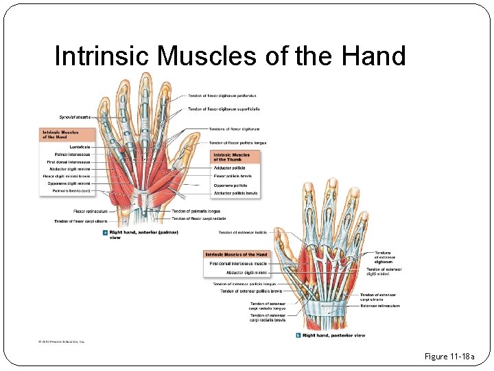 Intrinsic Muscles of the Hand Figure 11– 18 a 