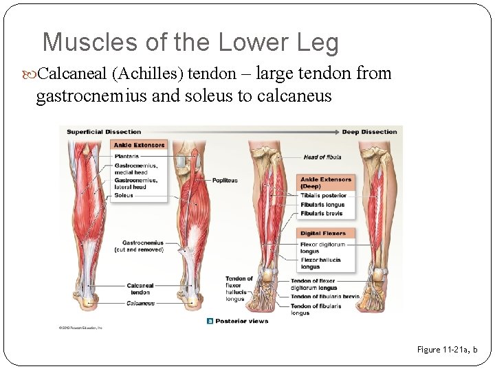 Muscles of the Lower Leg – large tendon from gastrocnemius and soleus to calcaneus