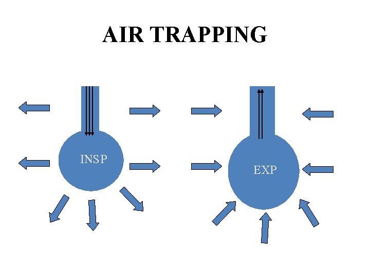 AIR TRAPPING INSP EXP 