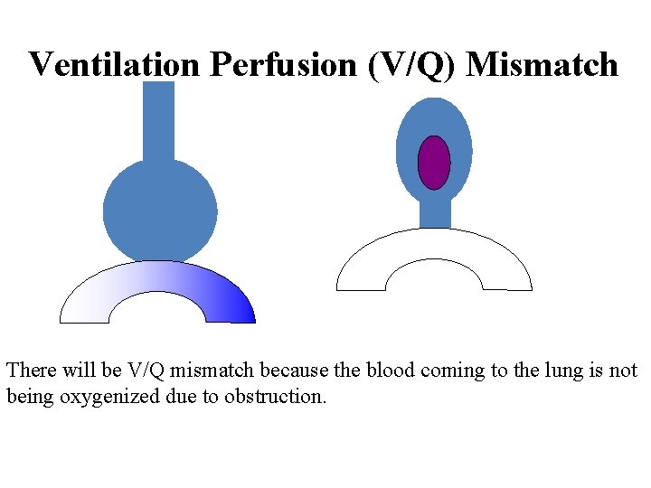 Ventilation Perfusion (V/Q) Mismatch There will be V/Q mismatch because the blood coming to