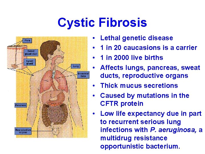 Cystic Fibrosis • • Lethal genetic disease 1 in 20 caucasions is a carrier