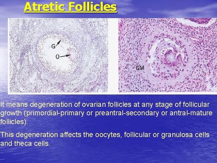 Atretic Follicles It means degeneration of ovarian follicles at any stage of follicular growth