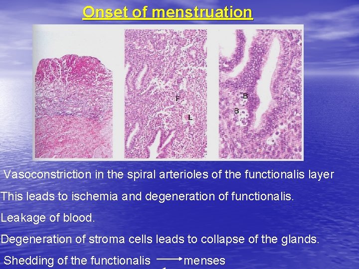 Onset of menstruation Vasoconstriction in the spiral arterioles of the functionalis layer This leads