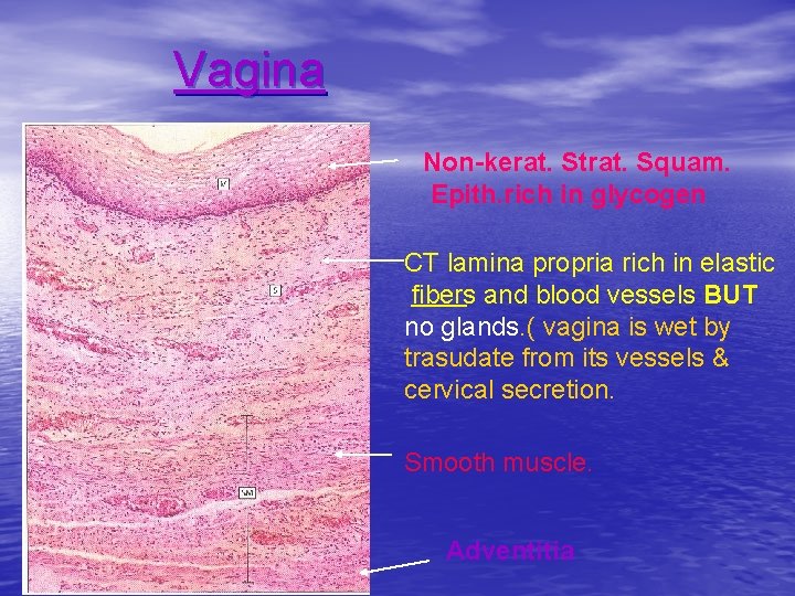 Vagina Non-kerat. Strat. Squam. Epith. rich in glycogen CT lamina propria rich in elastic