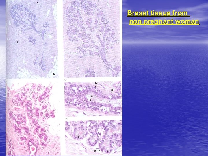 Breast tissue from non pregnant woman 