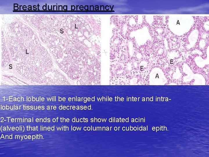 Breast during pregnancy 1 -Each lobule will be enlarged while the inter and intralobular