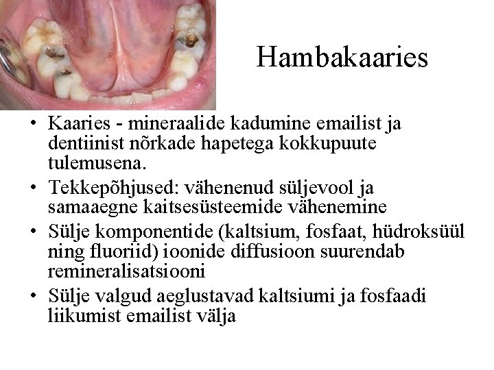 Hambakaaries • Kaaries - mineraalide kadumine emailist ja dentiinist nõrkade hapetega kokkupuute tulemusena. •