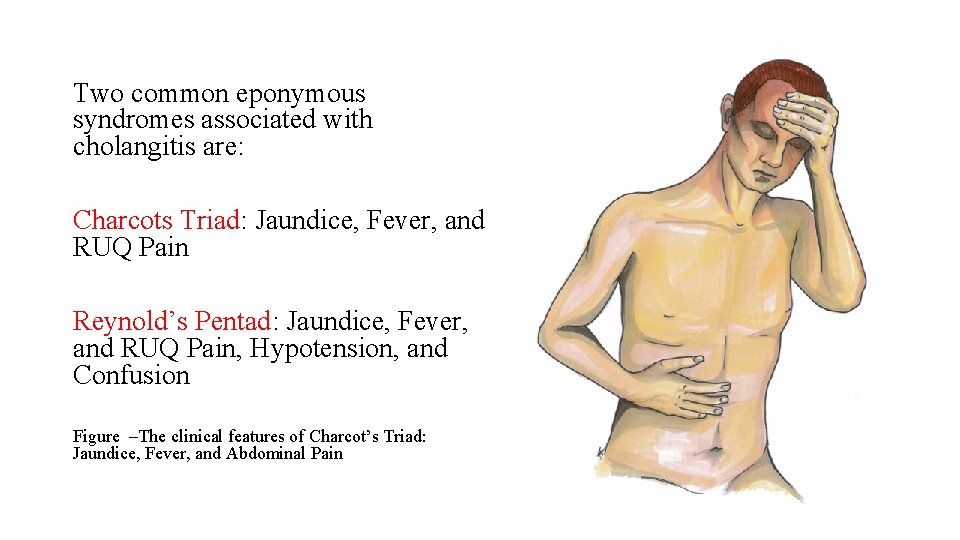Two common eponymous syndromes associated with cholangitis are: Charcots Triad: Jaundice, Fever, and RUQ