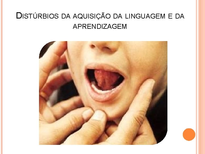 DISTÚRBIOS DA AQUISIÇÃO DA LINGUAGEM E DA APRENDIZAGEM 