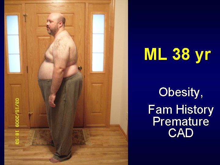 ML 38 yr Obesity, Fam History Premature CAD 