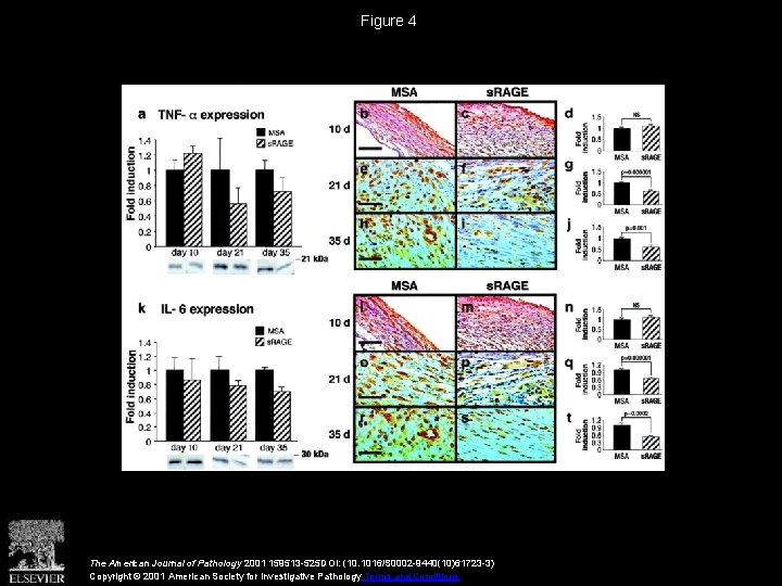 Figure 4 The American Journal of Pathology 2001 159513 -525 DOI: (10. 1016/S 0002