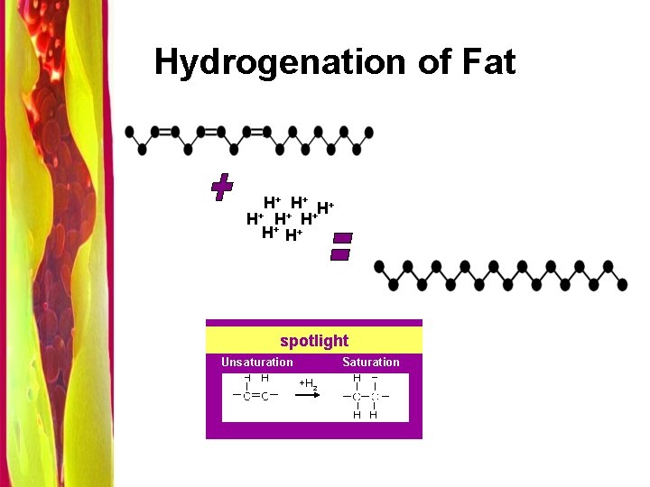 Hydrogenation of Fat H+ H+ spotlight Unsaturation Saturation +H 2 