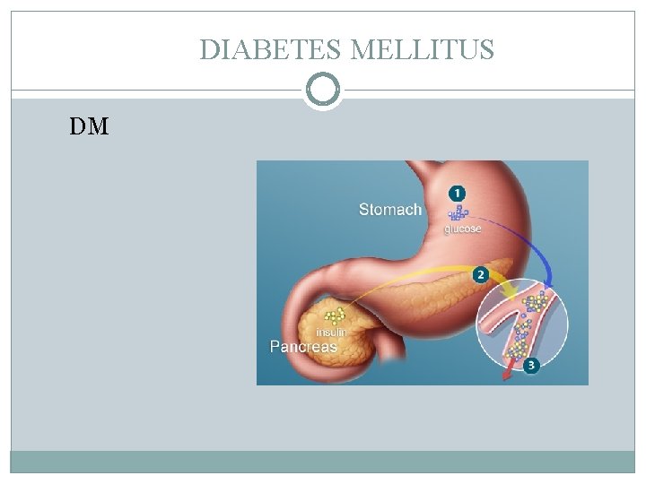 DIABETES MELLITUS DM 