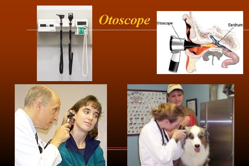 Otoscope 