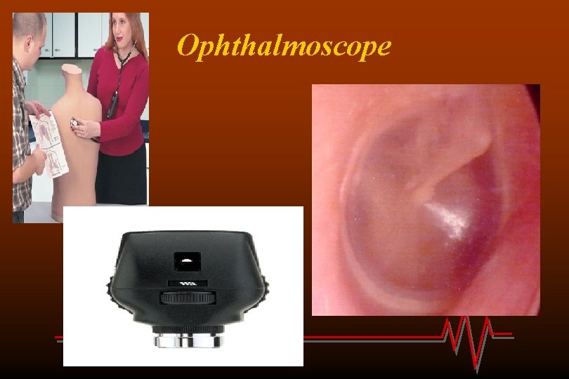Ophthalmoscope 