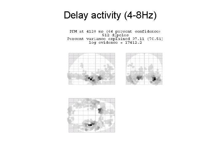 Delay activity (4 -8 Hz) 