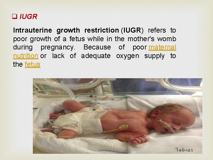 q IUGR Intrauterine growth restriction (IUGR) refers to poor growth of a fetus while