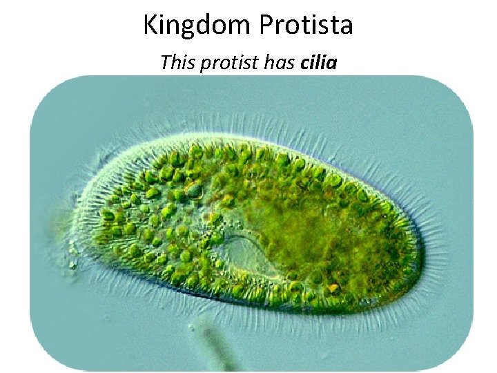 Kingdom Protista This protist has cilia 